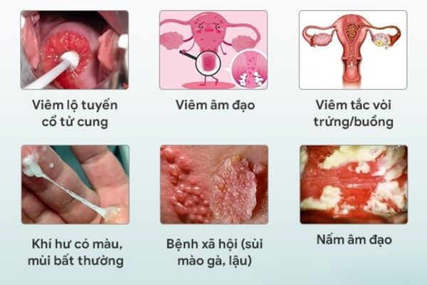 [Bật mí] Địa chỉ khám nam khoa chất lượng – giá tốt – an toàn