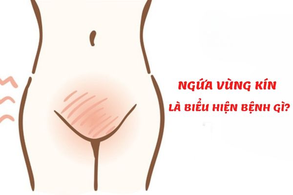 Ngứa vùng kín ở nữ giới là bệnh gì? – Cách điều trị hiệu quả nhất nên biết