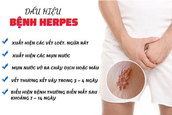 Tinh trùng vón cục – Nguy cơ cảnh báo vô sinh đáng báo động