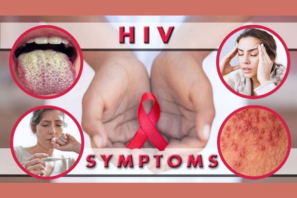 HIV/AIDS là bệnh lý nguy hiểm đáng báo động