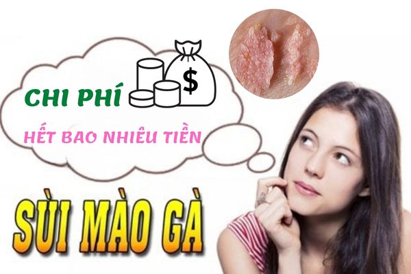 Chi phí khám chữa sùi mào gà hết bao nhiêu tiền? Có đắt không?