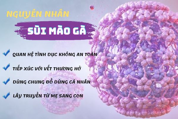 Sùi mào gà lây nhiễm qua nhiều con đường khác nhau