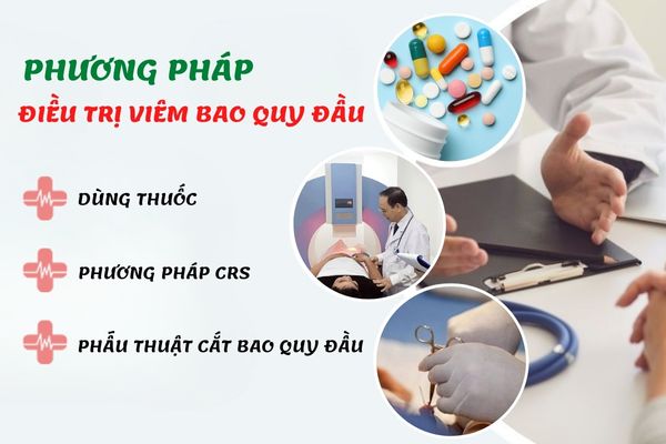 Phương pháp điều trị viêm bao quy đầu