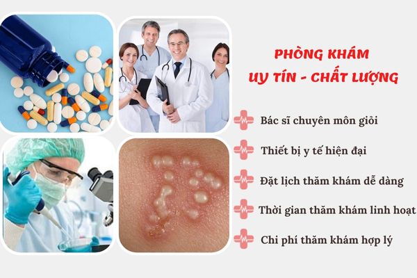 Địa chỉ chữa mụn rộp sinh dục uy tín