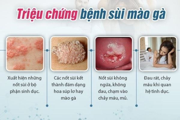 Lý do chậm kinh 1 tháng nhưng không có thai?