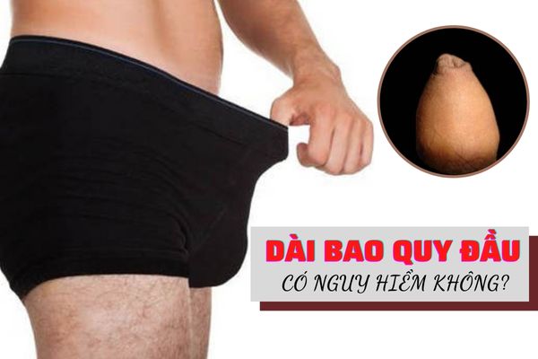 Nhận biết dài bao quy đầu như thế nào? Có nguy hiểm không?