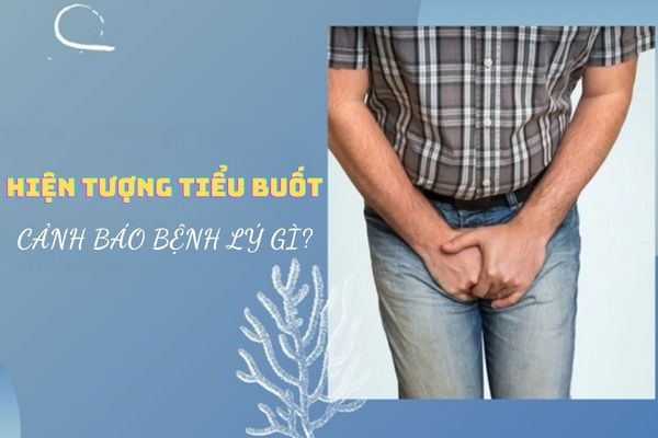 Hiện tượng tiểu buốt ở nam giới cảnh báo bệnh lý gì?