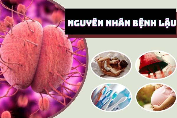 Nguyên nhân bệnh lậu do đâu? Có nguy hiểm không?