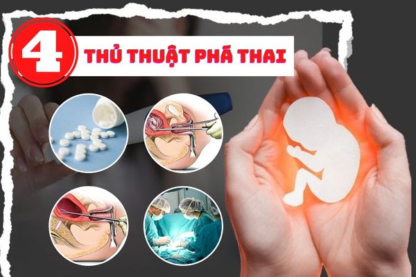 Tìm hiểu một số bệnh tinh hoàn phổ biến ở nam giới