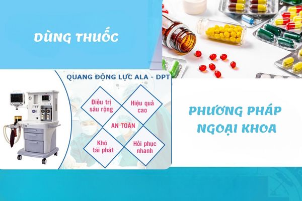 Phương pháp điều trị sùi mào gà hiệu quả