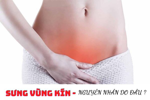 Tìm hiểu nguyên nhân gây sưng vùng kín và cách điều trị hiệu quả