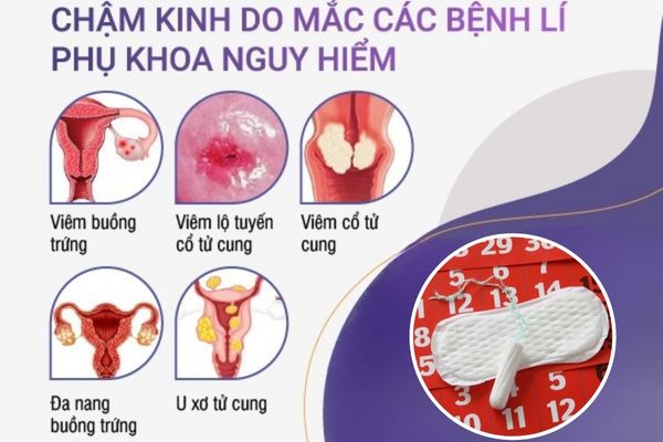 Các bệnh lý phụ khoa khiến chị em thường xuyên bị trễ kinh