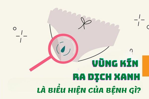 Vùng kín ra dịch xanh là biểu hiện của bệnh gì?