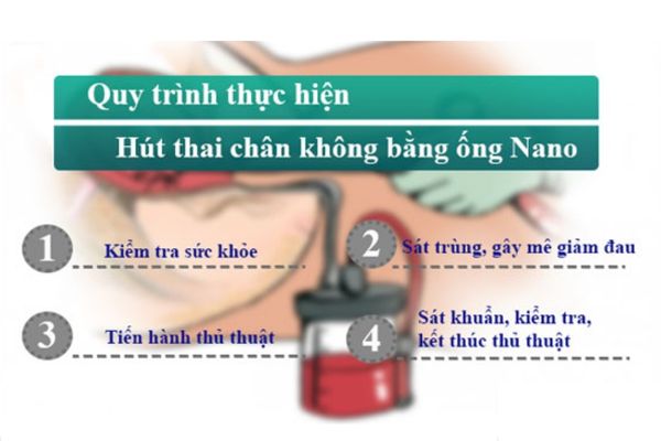 Nhung-luu-y-khi-pha-thai-tai-nha (3)